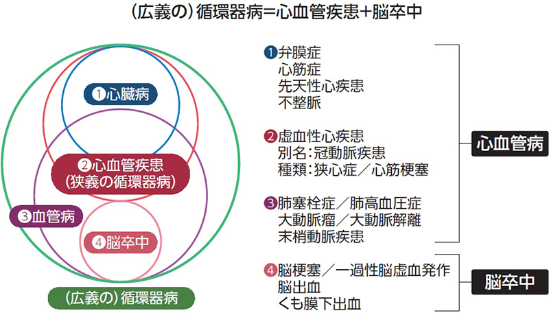 心臓の機能落ちる「心不全」、平均寿命延びて増えた理由とは？ (2