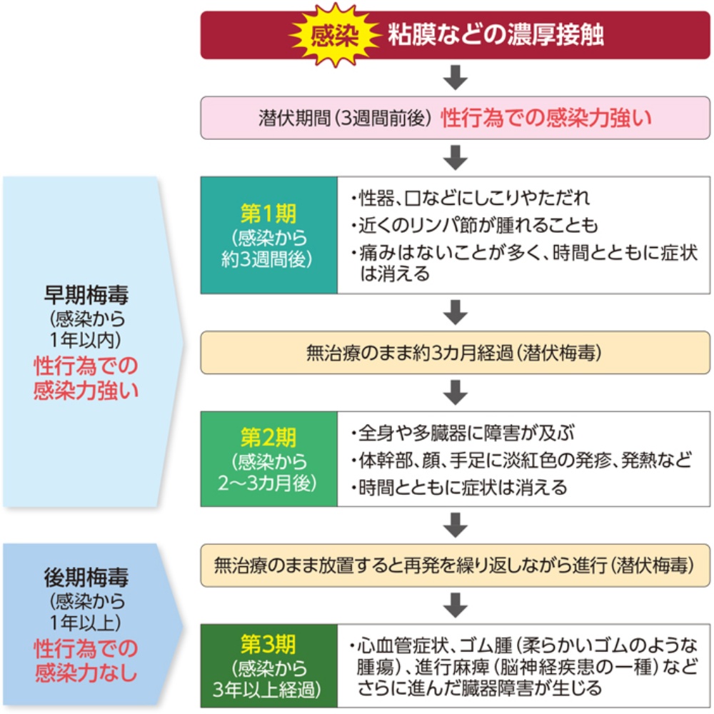 ウクライナ sex-art anal