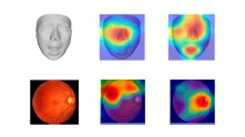 AIが老化の進行度を判定　顔・舌・網膜の写真を解析