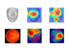 AIが老化の進行度を判定　顔・舌・網膜の写真を解析