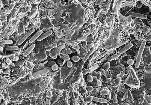 図5：土の微生物。コーヒースプーン2杯（10グラム）の土には100億個もの細菌が存在する（＊7）