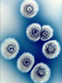 図6：ストレプトマイセス属のコロニー。白い物質が抗生物質にあたる。John Innes Centre （Norwich, UK）提供