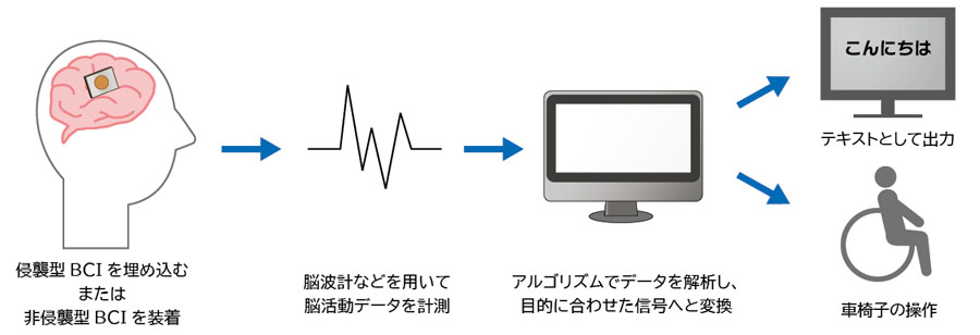 四肢まひ患者、脳から直接タブレット操作の現実味 頭部にチップ