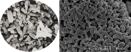 乾燥便1グラムに1兆個の腸内細菌が潜む（左）。一般的に広く知られる腸内細菌としてはビフィズス菌（右）や乳酸菌がある。