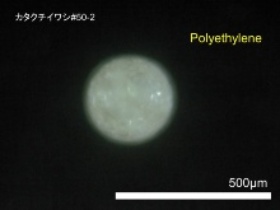 東京湾のカタクチイワシの消化管の中から出てきたマイクロビーズ。（写真提供：高田秀重）