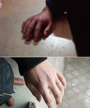 2007年、上海で再び働き始めたあかぎれだらけの16歳のチョウシュンの手（上）と、26歳になった彼の手