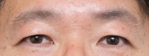 眉の横幅、長さともにあるが、余分な部分も多めでぼやけた印象に見える