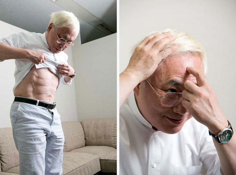 <b>整形手術で腹筋を割った高須院長</b>（左）<br /><b>頭皮には植毛。人工であることが分かるよう、あえて太い毛を植毛している</b>（右）