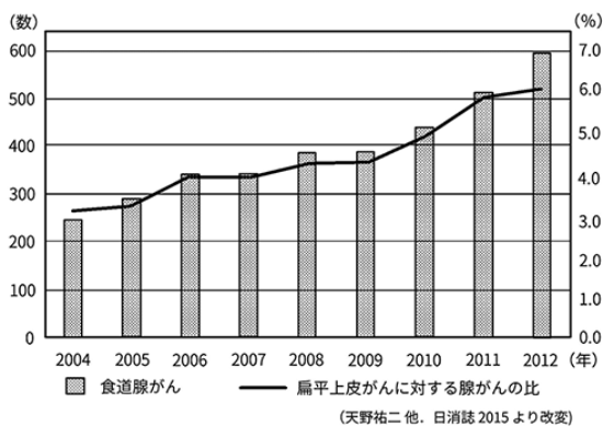 やっぱりピロリ菌の除菌で食道がんは増えた 日経ビジネス電子版
