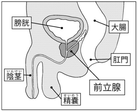急激に前立腺がんの患者が増えたのはなぜ?