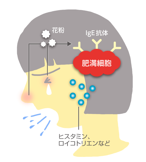 花粉症って 不治の病 なの 日経ビジネス電子版